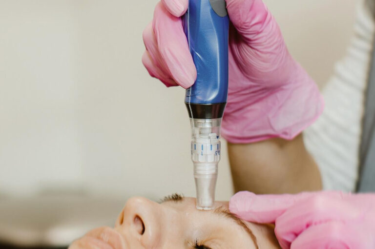 microneedling-misu-clinic-zürich