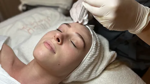 jetpeel Exfoliation